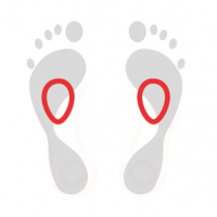 Insoles with metatarsal pads