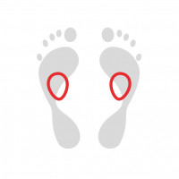 Insoles with metatarsal pads