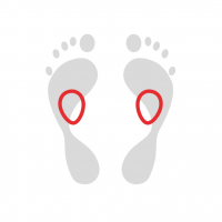 Insoles with metatarsal pads