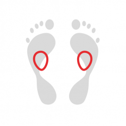 Insoles with metatarsal pads